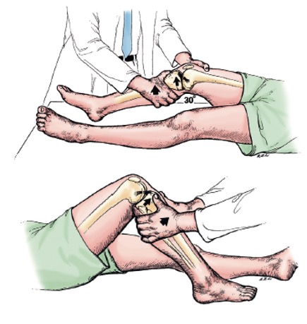 Ligamento Cruzado Porto Alegre Dr Leonardo Rocha Thomaz